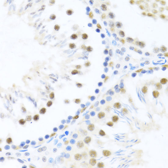 DDX46 Polyclonal Antibody