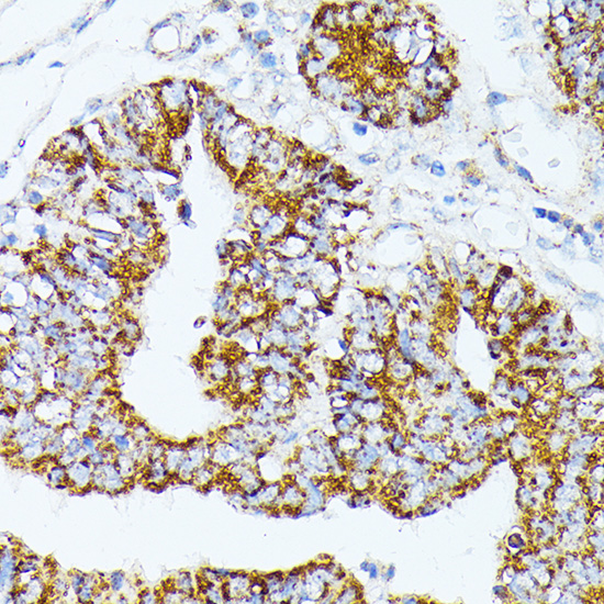 TRAP1 Rabbit Polyclonal Antibody