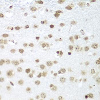 SAP18 Polyclonal Antibody