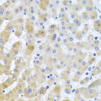 EIF3M Polyclonal Antibody