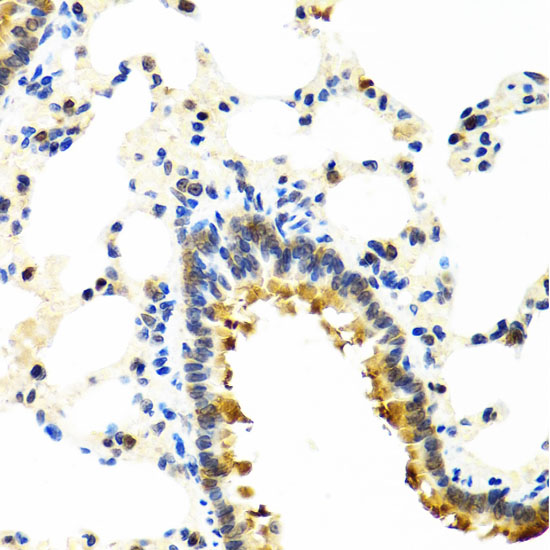 CRTAP Polyclonal Antibody