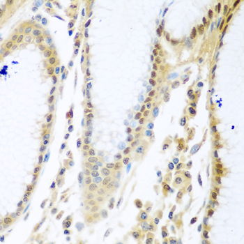 MYBBP1A Rabbit Polyclonal Antibody