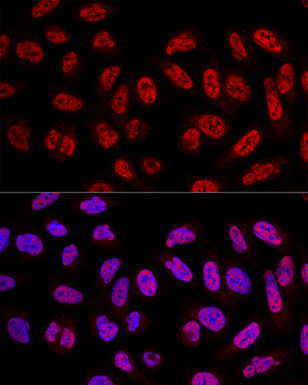 SF3A3 Rabbit Polyclonal Antibody