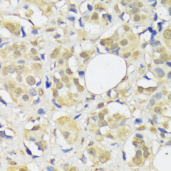 ADRM1 Rabbit Polyclonal Antibody