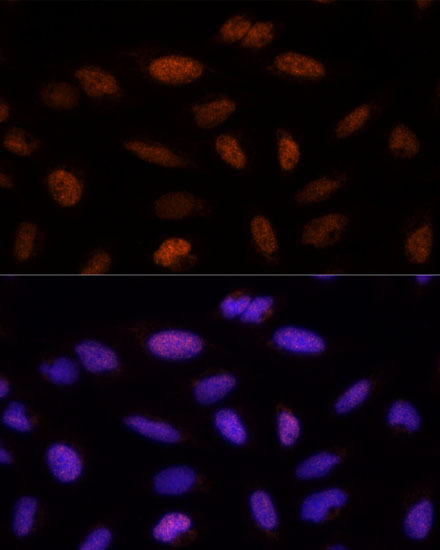 ADNP Rabbit Polyclonal Antibody