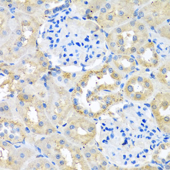 COTL1 Polyclonal Antibody