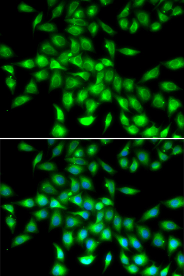 SERPINA10 Polyclonal Antibody