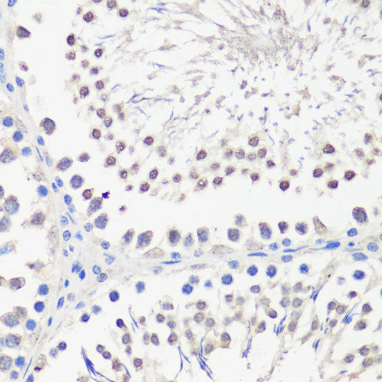 SPK Polyclonal Antibody