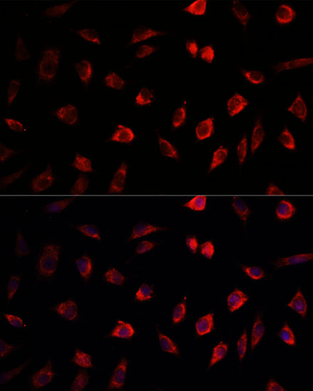 NEDD1 Polyclonal Antibody