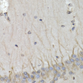 PSMB10 antibody