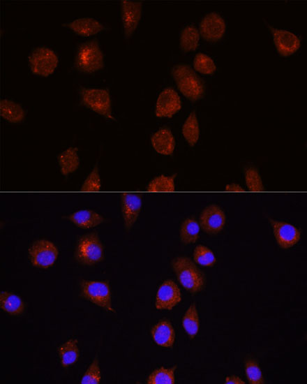 AKT Rabbit Polyclonal Antibody