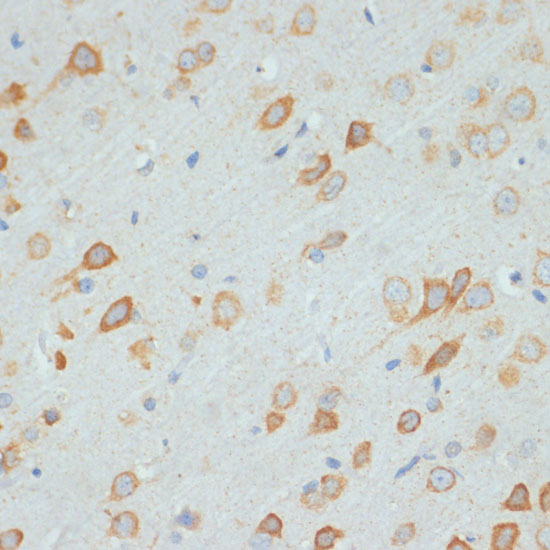 DDX3X Antibody