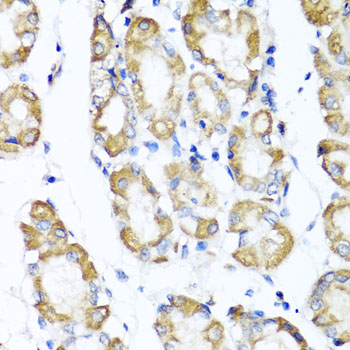 ST6GAL1 antibody