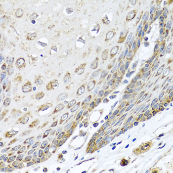 DEDD Polyclonal Antibody