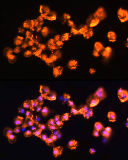 PRKCB Antibody