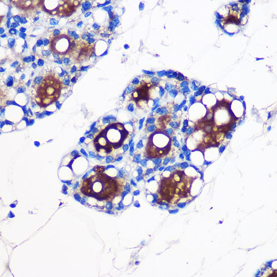 UCP1 antibody