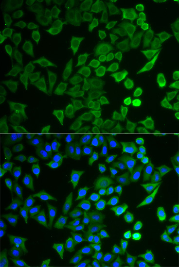 NPRL2 Antibody