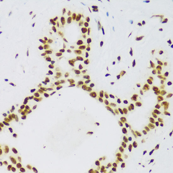 FUS Polyclonal Antibody