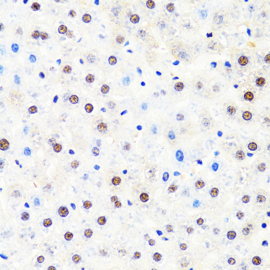 POLR2B Polyclonal Antibody