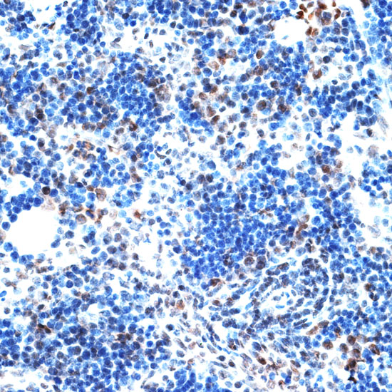 AQR Polyclonal Antibody