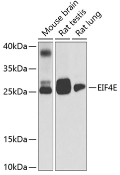 EIF4E Rabbit Polyclonal Antibody