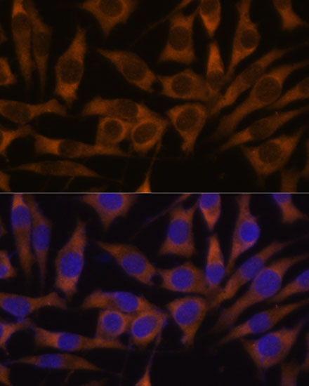 IGF2BP3 Rabbit Polyclonal Antibody