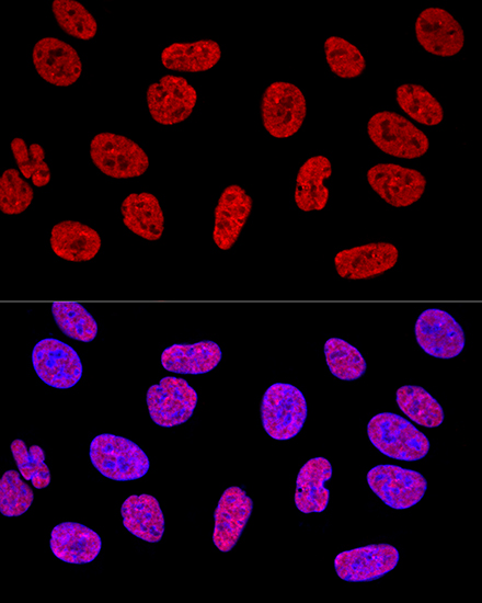 KHDRBS1 Rabbit Polyclonal Antibody
