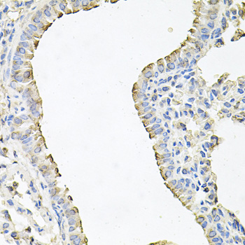 SCNN1G Rabbit Polyclonal Antibody