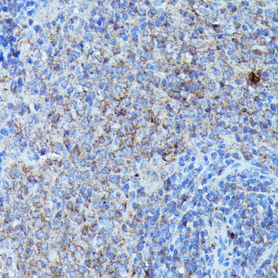 CSF3 Rabbit Polyclonal Antibody