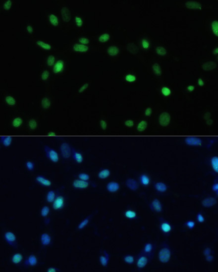 SET antibody