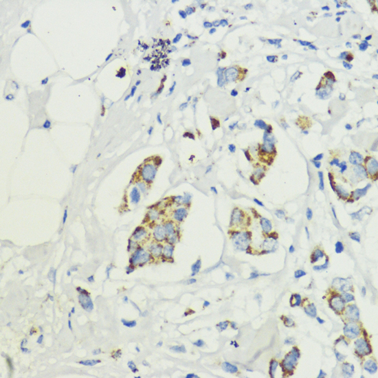 AKT1S1 antibody