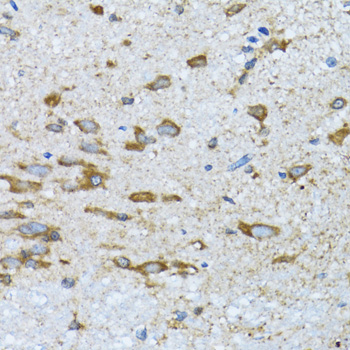 PDP1 antibody