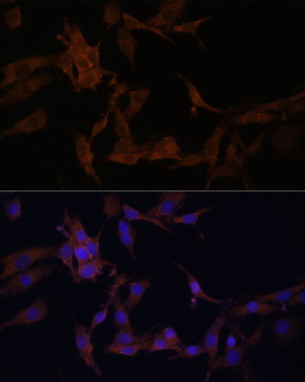 SERPINB9 antibody