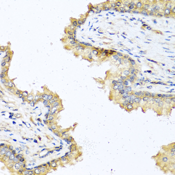DEFB121 antibody