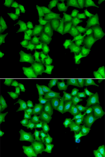 CPSF3L antibody