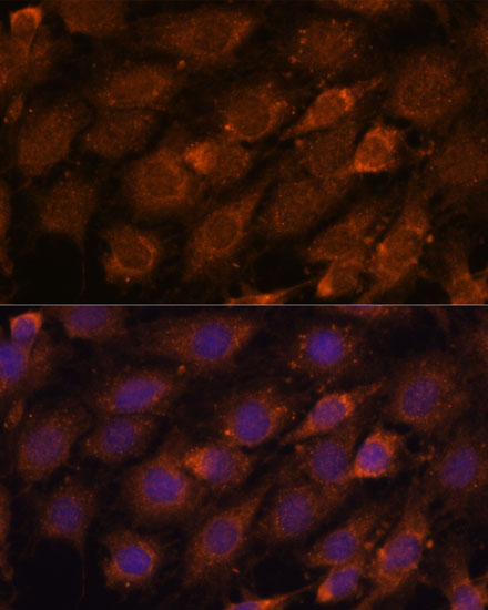 CREB3 antibody