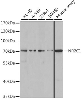 NR2C1 Rabbit Polyclonal Antibody