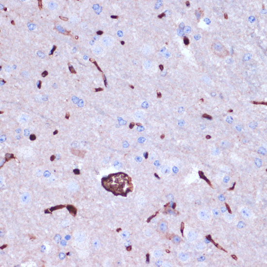 PROK2 Polyclonal Antibody