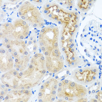 RPS2 Rabbit Polyclonal Antibody