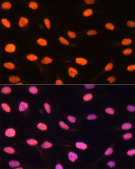 ZBED1 Polyclonal Antibody