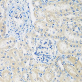 ENPEP Rabbit Polyclonal Antibody