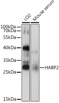 HABP2 Rabbit Polyclonal Antibody
