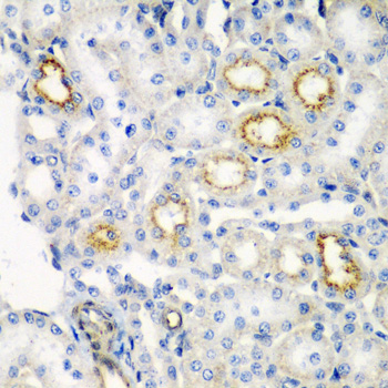 RARRES2 Polyclonal Antibody
