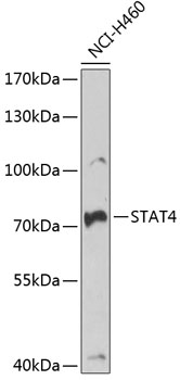 STAT4 Rabbit Polyclonal Antibody