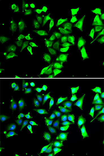 FKBP8 Rabbit Polyclonal Antibody