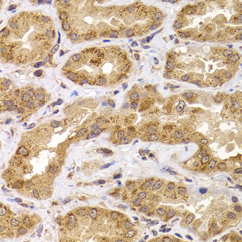 ANAPC5 Rabbit Polyclonal Antibody