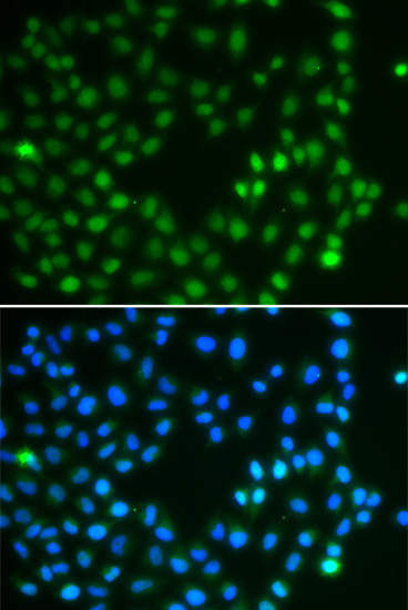 SALL4 Rabbit Polyclonal Antibody