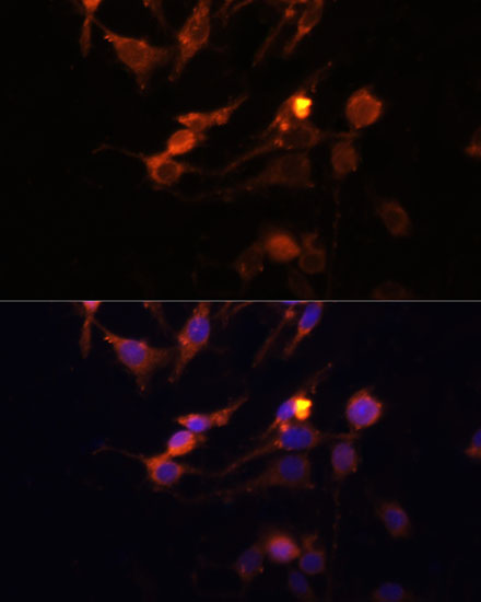 PINK1 Rabbit Polyclonal Antibody