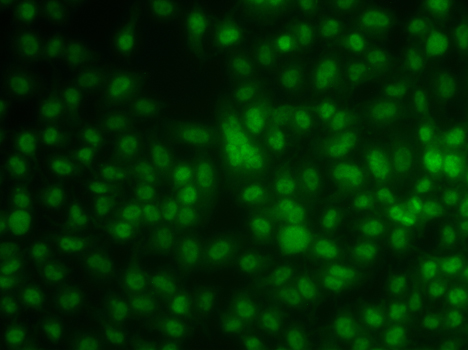 KLF3 Polyclonal Antibody
