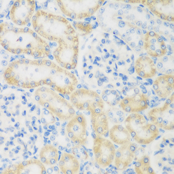 NAT8B Polyclonal Antibody